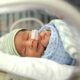 which babies need NICU care