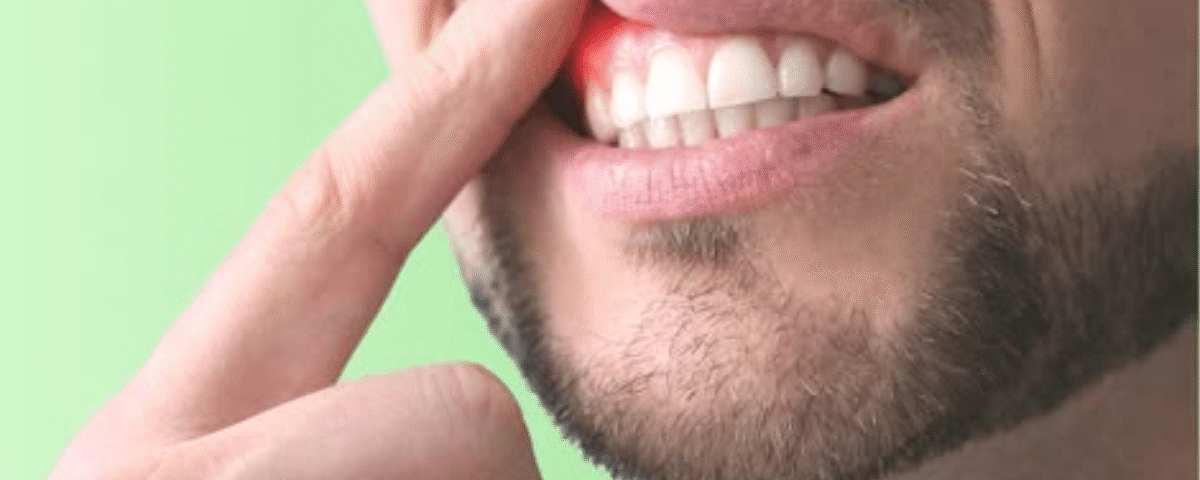 how to keep your gums healthy