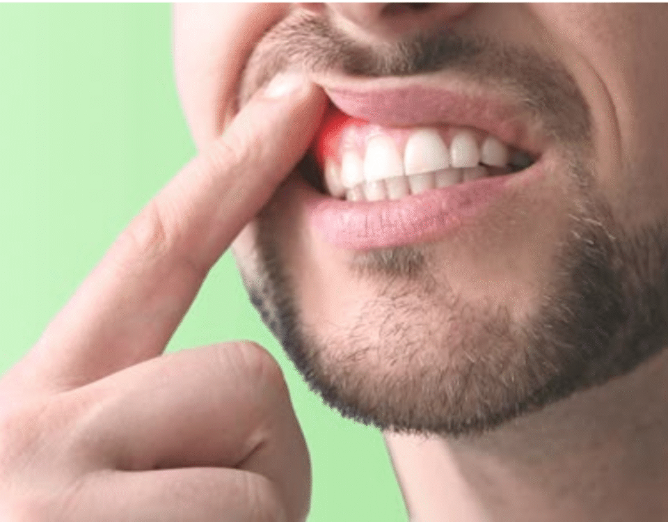 how to keep your gums healthy