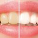 best foods for healthy teeth and gums
