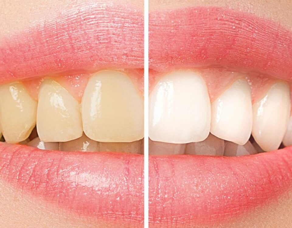 best foods for healthy teeth and gums