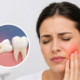 wisdom tooth removal