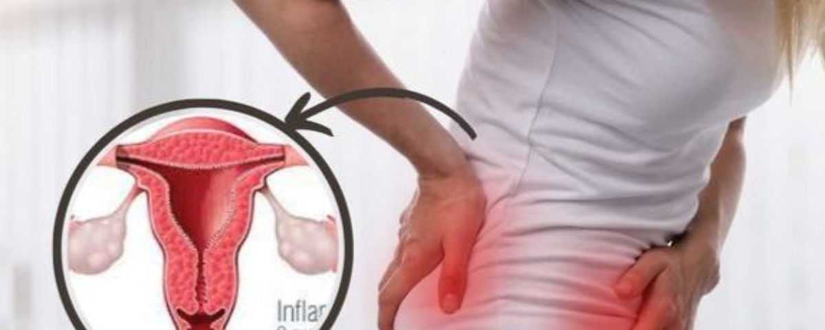 uterine fibroids