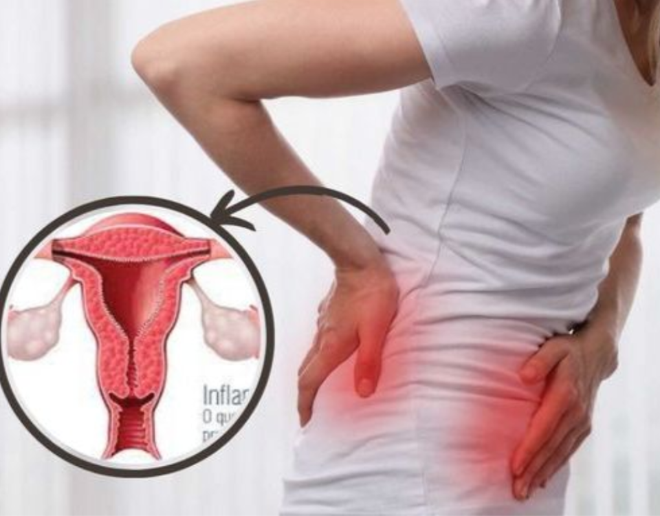 uterine fibroids